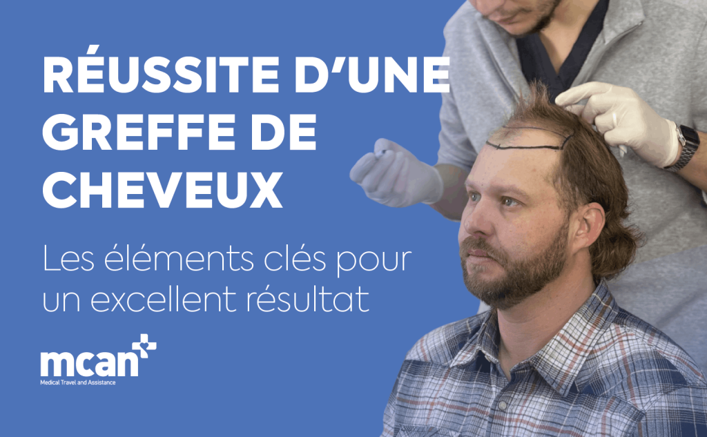 Hair Transplant Success de