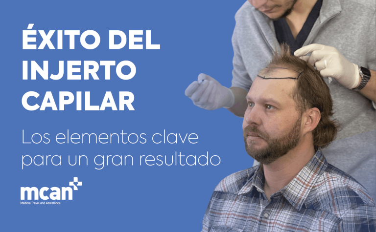 Éxito del injerto capilar: los elementos clave para un gran resultado 4 Hair Transplant Success nl Hair Transplant Success nl