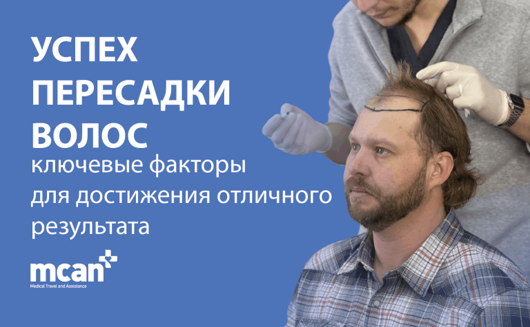 Hair Transplant Success ru