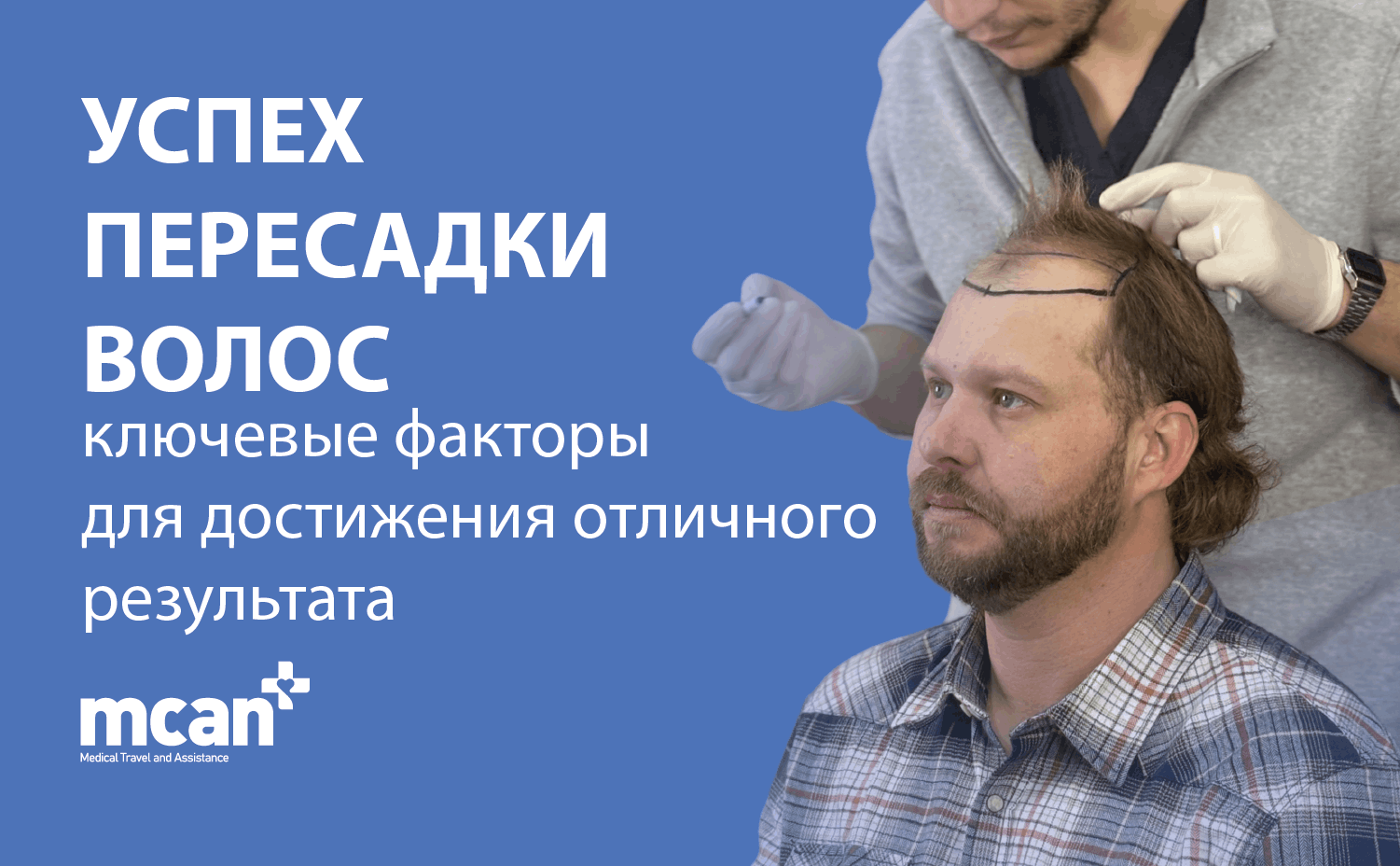 Успех пересадки волос: ключевые факторы для достижения отличного результата 12 Hair Transplant Success ru Hair Transplant Success ru