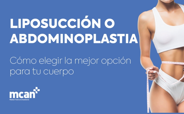 Liposucción o abdominoplastia: cómo elegir la mejor opción para tu cuerpo 11 Liposuction or Tummy Tuck es Liposuction or Tummy Tuck es
