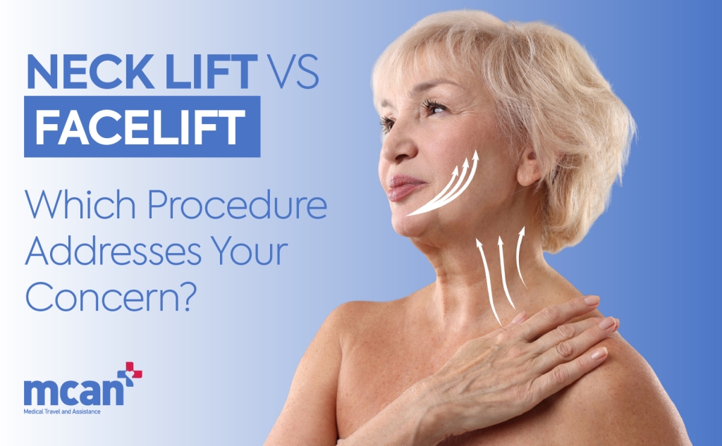 Neck Lift vs Facelift