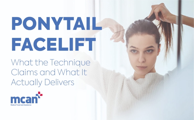 Ponytail Facelift: What the Technique Claims and What It Actually Delivers