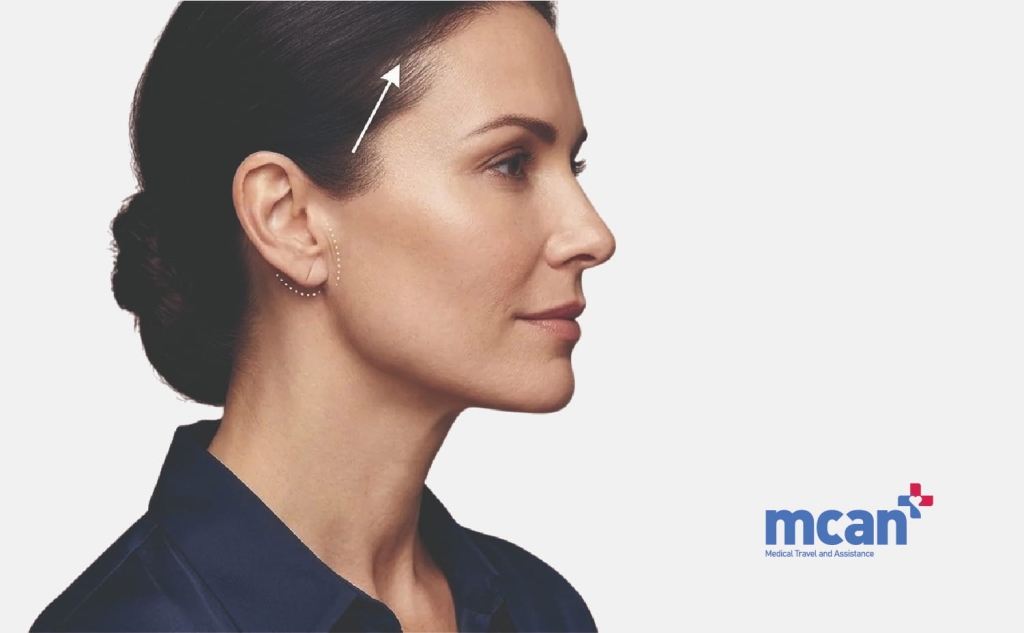 Ponytail Facelift: What the Technique Claims and What It Actually Delivers 3 Ponytail Facelift vs Mini Facelift Ponytail Facelift vs Mini Facelift