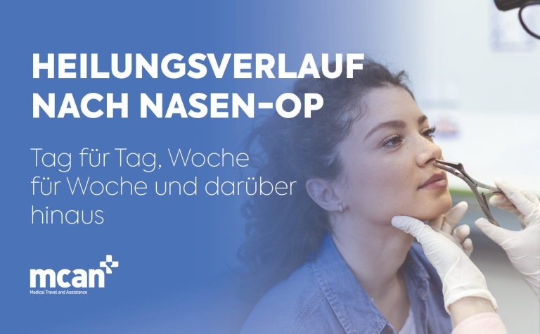 Heilungsverlauf nach Nasen-OP: Tag für Tag, Woche für Woche und darüber hinaus 8 Rhinoplasty Recovery Timeline DE Rhinoplasty Recovery Timeline DE