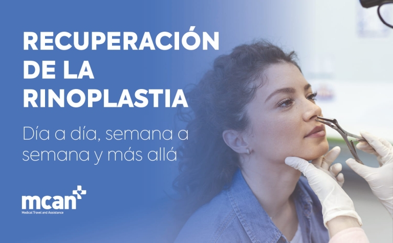 Recuperación de la rinoplastia: día a día, semana a semana y más allá 9 Rhinoplasty Recovery Timeline ES Rhinoplasty Recovery Timeline ES