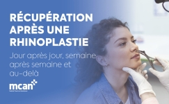 Rhinoplasty Recovery Timeline FR