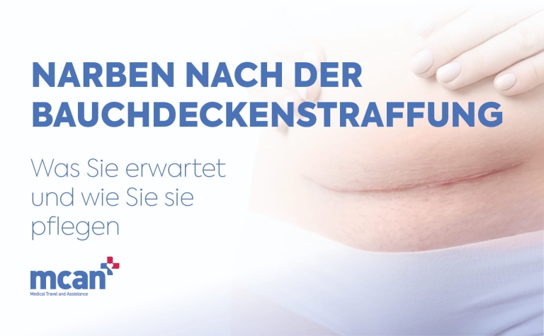 Narben nach der Bauchdeckenstraffung: Was Sie erwartet und wie Sie sie pflegen 9 Tummy Tuck Scars DE Tummy Tuck Scars DE