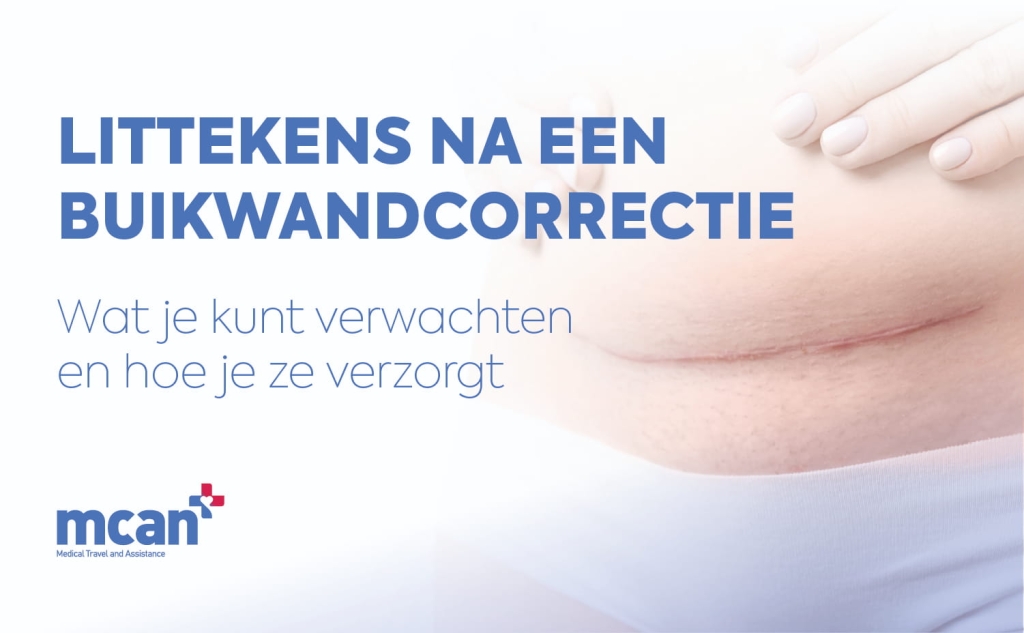 Littekens na een buikwandcorrectie: wat je kunt verwachten en hoe je ze verzorgt 1 Tummy Tuck Scars NL Tummy Tuck Scars NL