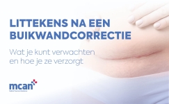 Tummy Tuck Scars NL
