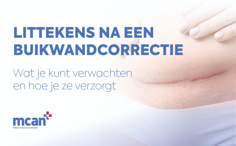 Littekens na een buikwandcorrectie: wat je kunt verwachten en hoe je ze verzorgt 6 Tummy Tuck Scars NL Tummy Tuck Scars NL