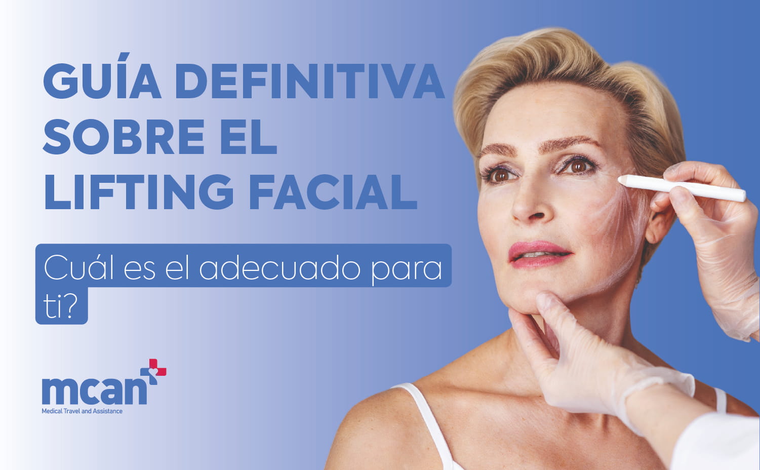 Ultimate Guide to Facelift Procedures ES