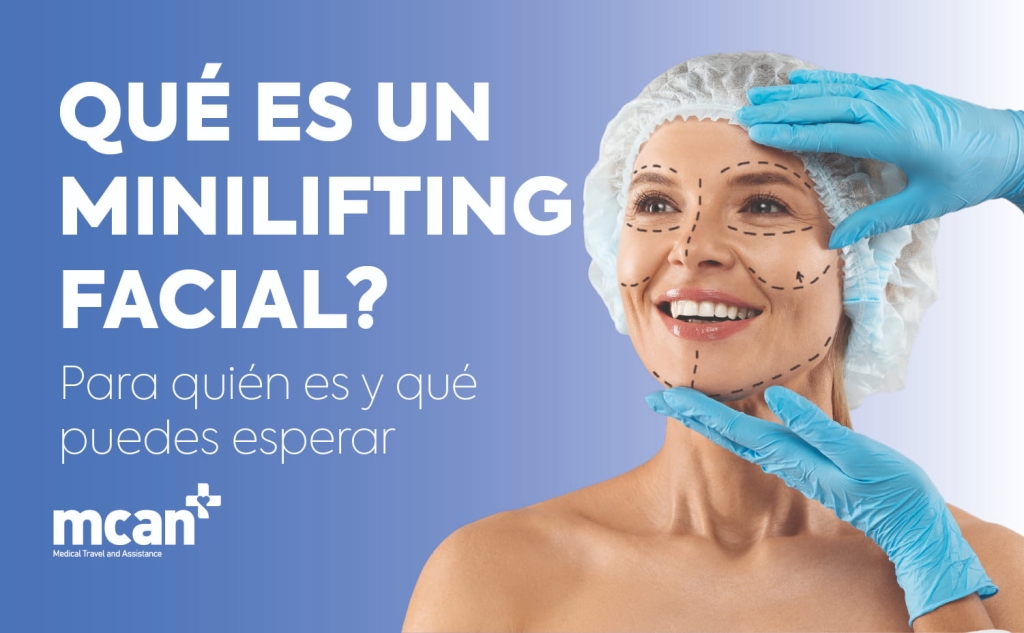 Qu’est-ce qu’un mini lifting du visage ? Pour qui et à quoi s’attendre 1 What Is a Mini Facelift es What Is a Mini Facelift es