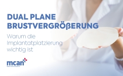 Dual Plane Breast Augmentation de 1
