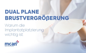 Dual Plane Breast Augmentation de 1