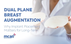 Dual Plane Breast Augmentation en