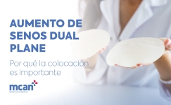 Dual Plane Breast Augmentation es 1