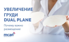 Dual Plane Breast Augmentation ru 1