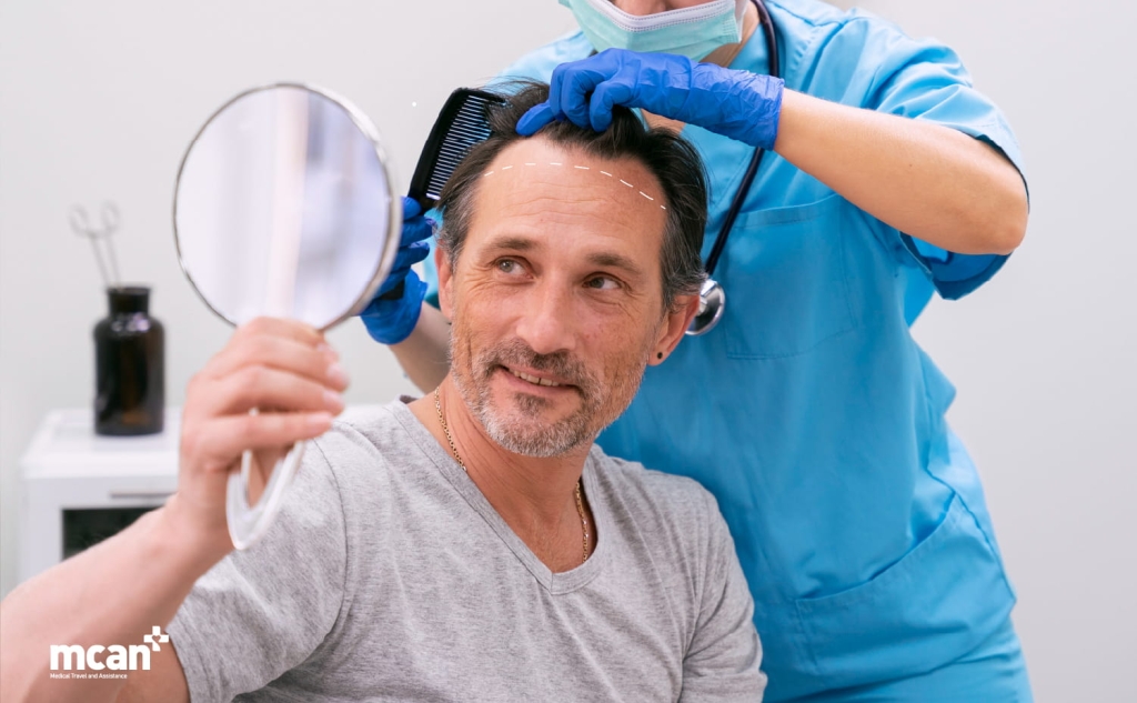 M-Shaped Hairline: Causes and Hair Transplant Solutions 4 Hair Transplant Solutions for an M Shaped Hairline Hair Transplant Solutions for an M Shaped Hairline