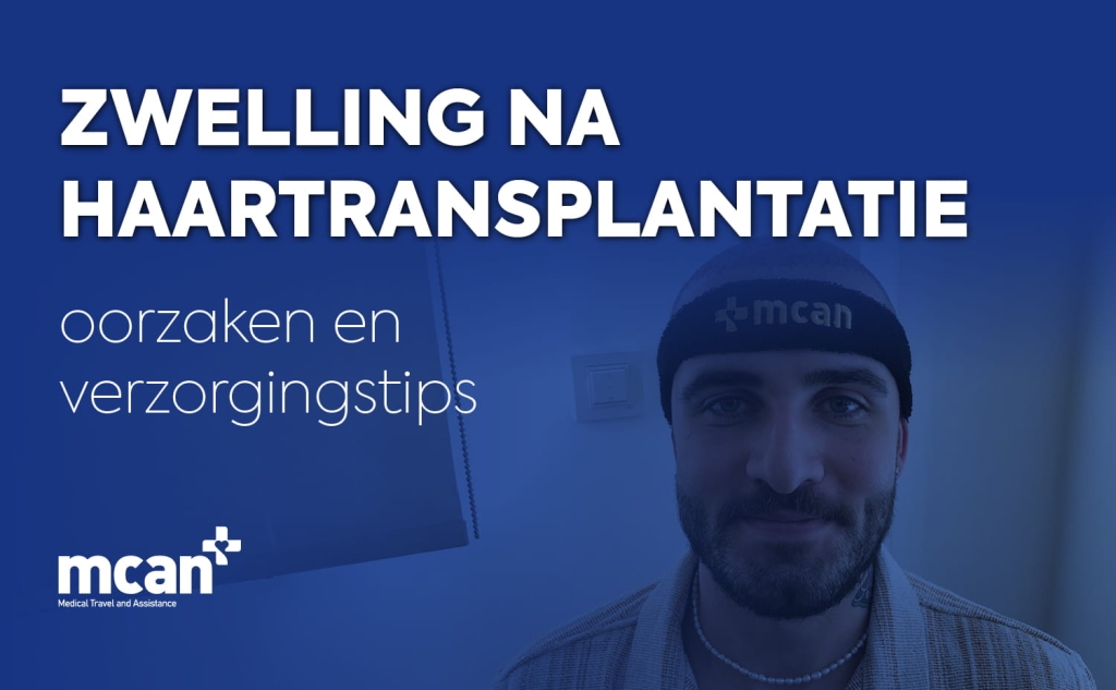Zwelling na haartransplantatie: oorzaken en verzorgingstips 1 Hair Transplant Swelling fr 1 Hair Transplant Swelling fr 1