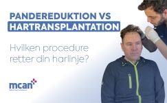 Hairline Lowering Surgery vs Hair Transplant da