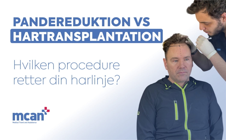 Hairline Lowering Surgery vs Hair Transplant da
