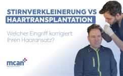 Hairline Lowering Surgery vs Hair Transplant de