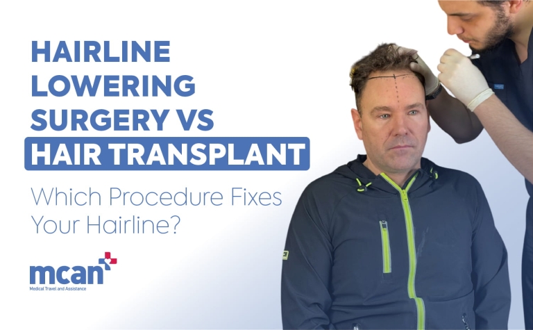 Hairline Lowering Surgery vs Hair Transplant: Which Procedure Fixes Your Hairline?