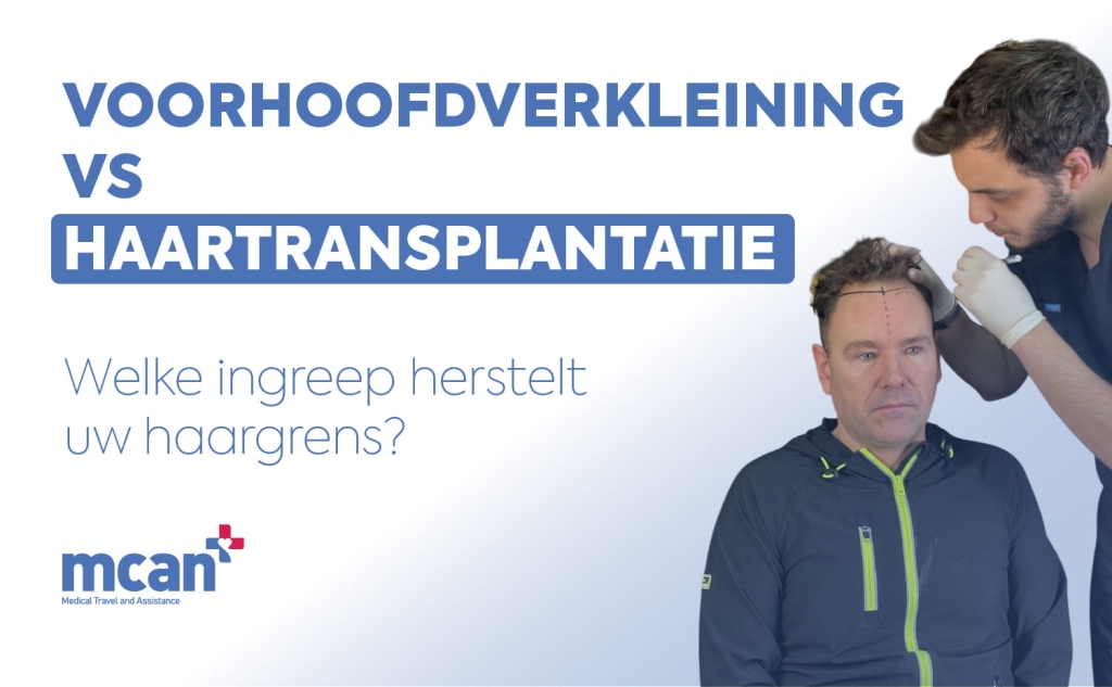 Hairline Lowering Surgery vs Hair Transplant nl