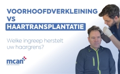 Hairline Lowering Surgery vs Hair Transplant nl