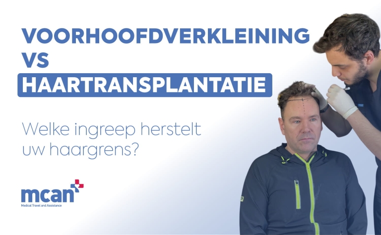 Voorhoofdverkleining vs haartransplantatie: welke ingreep herstelt uw haargrens? 8 Hairline Lowering Surgery vs Hair Transplant nl Hairline Lowering Surgery vs Hair Transplant nl