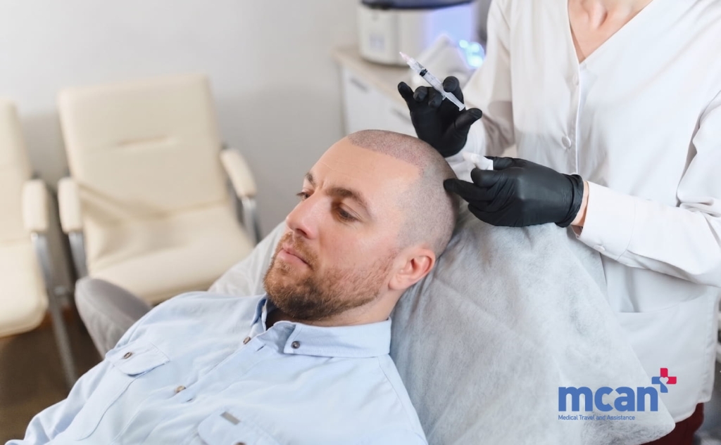 How to Fix Cobblestoning After a Hair Transplant