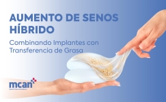 Hybrid Breast Augmentation es