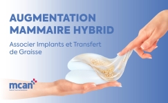 Hybrid Breast Augmentation fr