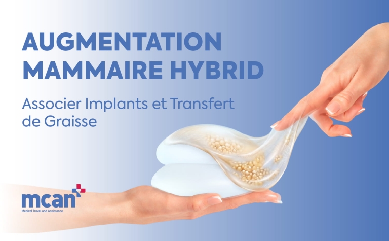Augmentation Mammaire Hybride : Associer Implants et Transfert de Graisse 4 Hybrid Breast Augmentation fr Hybrid Breast Augmentation fr