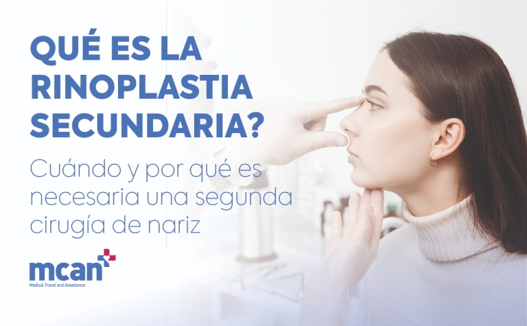 ¿Qué es la rinoplastia secundaria? Cuándo y por qué es necesaria una segunda cirugía de nariz 7 Revision Rhinoplasty es Revision Rhinoplasty es