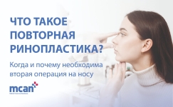 Revision Rhinoplasty ru