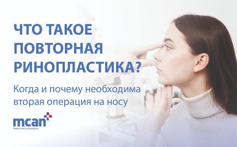 Что такое повторная ринопластика? Когда и почему необходима вторая операция на носу 7 Revision Rhinoplasty ru Revision Rhinoplasty ru
