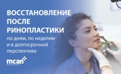 Rhinoplasty Recovery Timeline RU