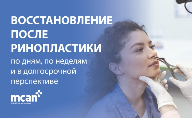 Восстановление после ринопластики: по дням, по неделям и в долгосрочной перспективе 9 Rhinoplasty Recovery Timeline RU Rhinoplasty Recovery Timeline RU