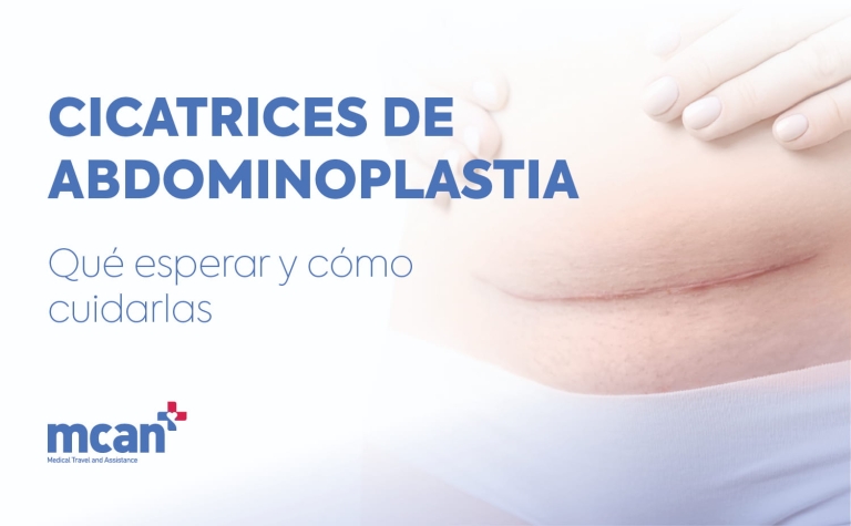 Cicatrices de abdominoplastia: qué esperar y cómo cuidarlas 6 Tummy Tuck Scars ES Tummy Tuck Scars ES