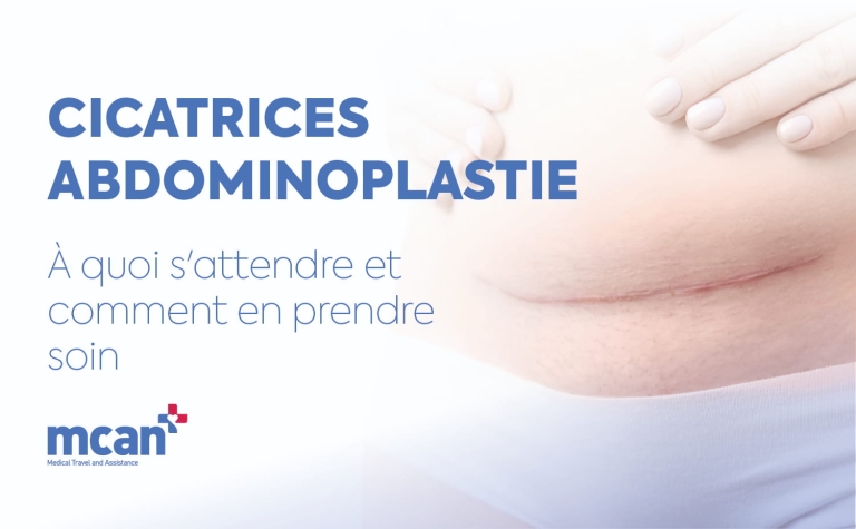 Cicatrices abdominoplastie : à quoi s attendre et comment en prendre soin 6 Tummy Tuck Scars FR Tummy Tuck Scars FR