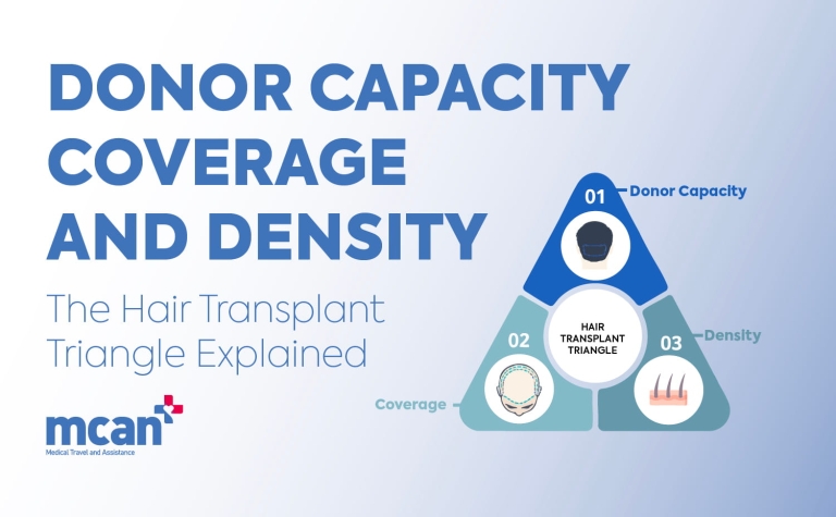 Donor Capacity, Coverage, and Density: The Hair Transplant Triangle Explained