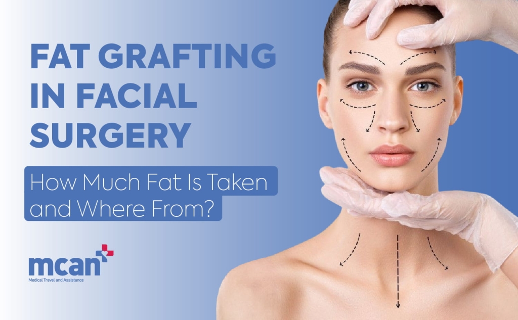 Fat Grafting in Facial Surgery: How Much Fat Is Taken and Where From? 1 Fat Grafting in Facial Surgery en Fat Grafting in Facial Surgery en