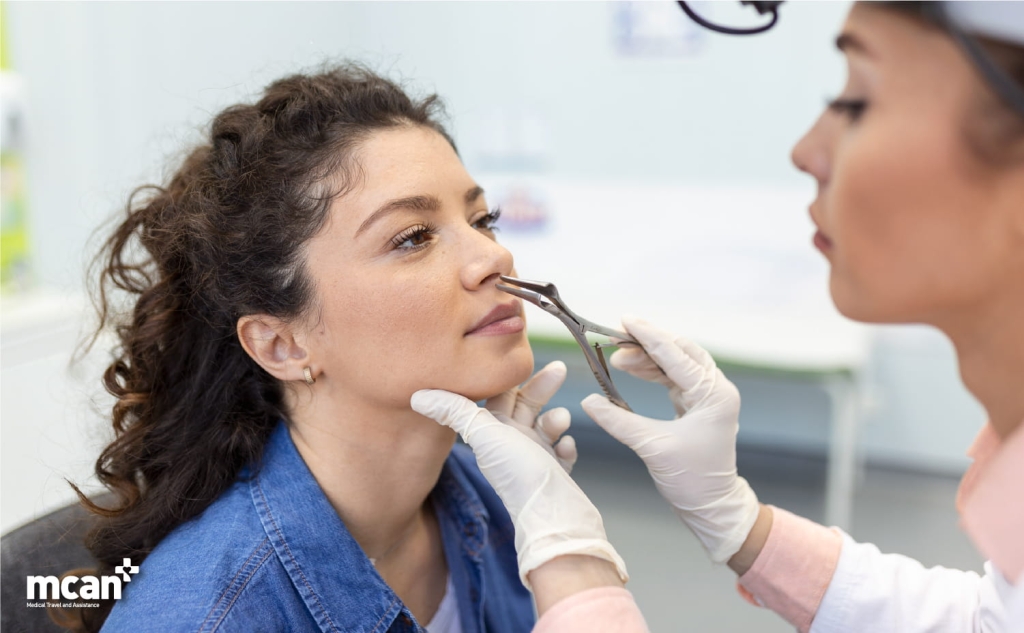 Preservation Rhinoplasty Recovery 6