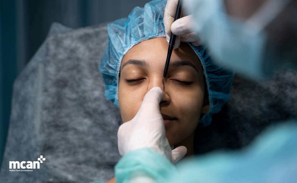 Treatment Options for a Crooked Nose 1