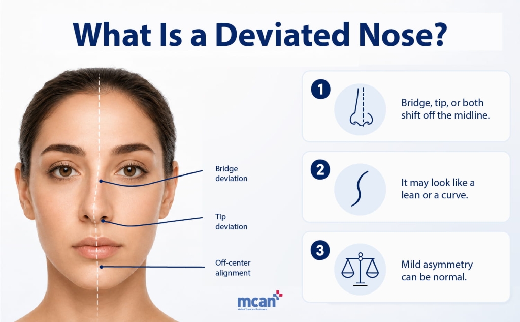 Crooked Nose Correction: Functional and Cosmetic Considerations 2 What Is a Crooked Nose EN 1 What Is a Crooked Nose EN 1