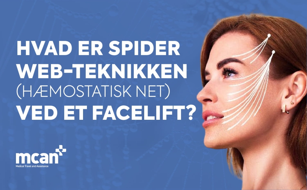 Hvad er spider web-teknikken (hæmostatisk net) ved et facelift? 1 What Is the Spider Web Technique Hemostatic Net in Facelift Surgery da What Is the Spider Web Technique Hemostatic Net in Facelift Surgery da