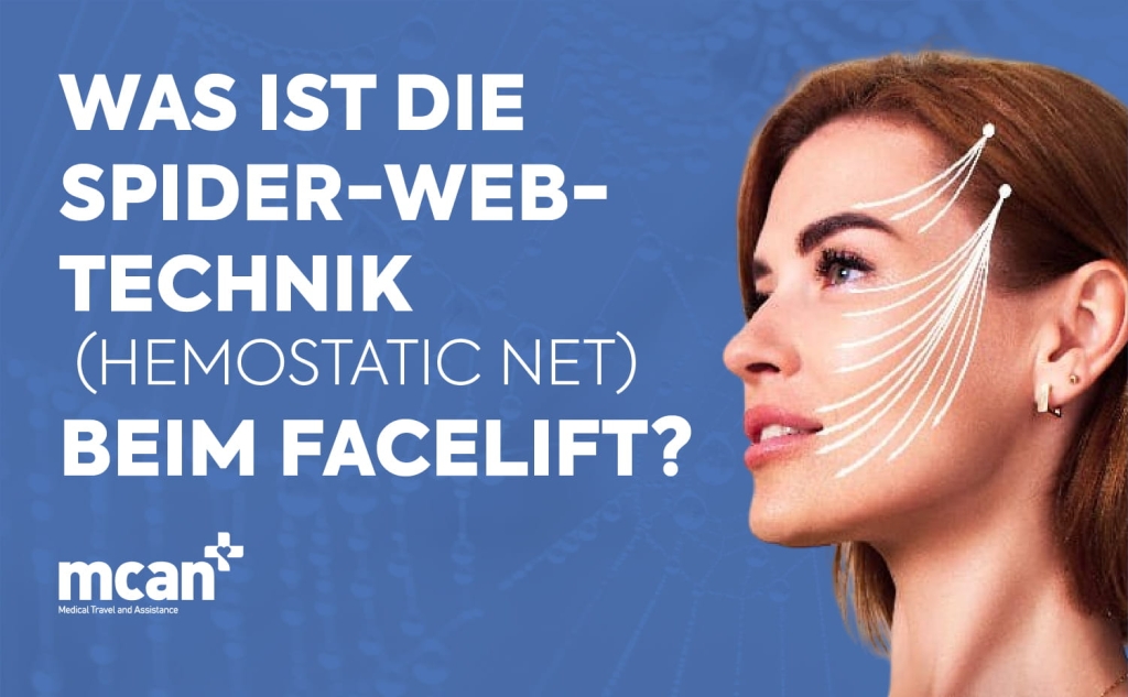 Was ist die Spider-Web-Technik (Hemostatic Net) beim Facelift? 1 What Is the Spider Web Technique Hemostatic Net in Facelift Surgery de What Is the Spider Web Technique Hemostatic Net in Facelift Surgery de