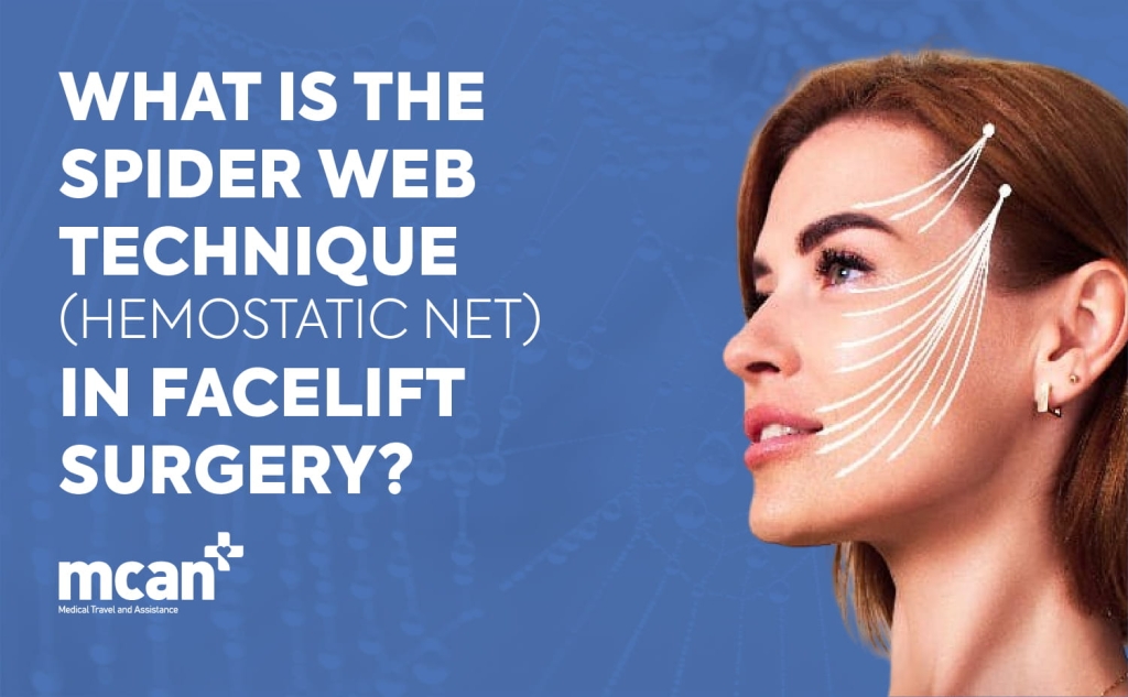 What Is the Hemostatic Net Technique (Spider Web) in Facelift Surgery? 1 What Is the Spider Web Technique Hemostatic Net in Facelift Surgery en What Is the Spider Web Technique Hemostatic Net in Facelift Surgery en